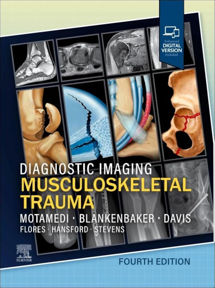 Couverture du livre « DIAGNOSTIC IMAGING: MUSCULOSKELETAL TRAUMA » de Motamedi/davis, librairie Les Contes Infusés à Corte