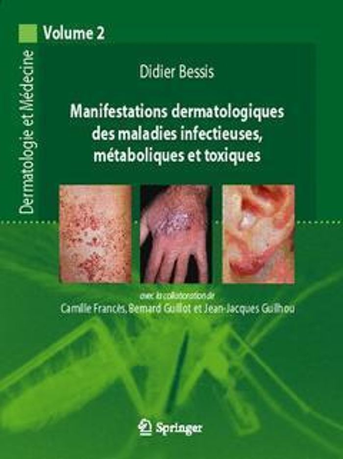 Couverture du livre « MANIFESTATIONS DERMATOLOGIQUES DES MALADIES INFECTIEUSES, METABOLIQUES ET TOXIQUES - VOL. 2 » de Bessis/frances, librairie Les Contes Infusés à Corte
