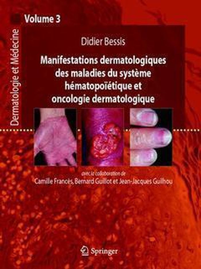 Couverture du livre « MANIFESTATIONS DERMATOLOGIQUES DES MALADIES DU SYSTEME HEMATOPOIETIQUE ET ONCOLOGIE DERMATOLOGIQUE - », librairie Les Contes Infusés à Corte