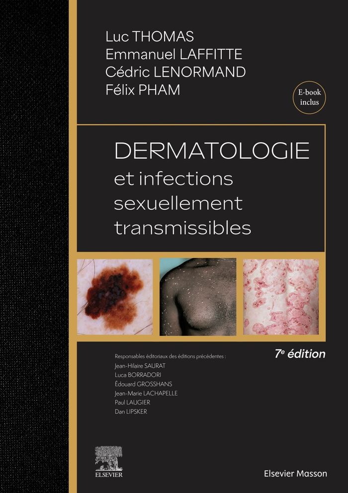Couverture du livre « Dermatologie et infections sexuellement transmissibles » de [coordonné par] Luc Thomas, librairie Les Contes Infusés à Corte