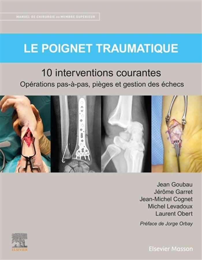Couverture du livre « LE POIGNET TRAUMATIQUE 10 INTERVENTIONS COURANTES - MANUEL DE CHIRURGIE DU MEMBRE SUPERIEUR », librairie Les Contes Infusés à Corte