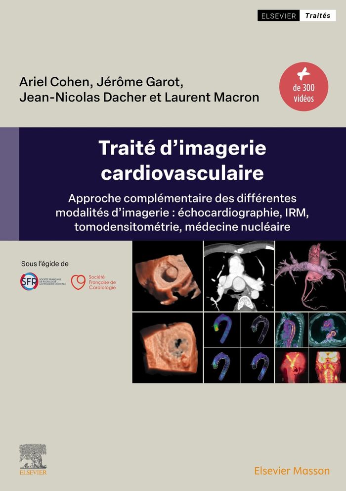 Couverture du livre « Traité d'imagerie cardiovasculaire : approche complémentaire des différentes modalités d'imagerie » de Ariel Cohen, librairie Les Contes Infusés à Corte