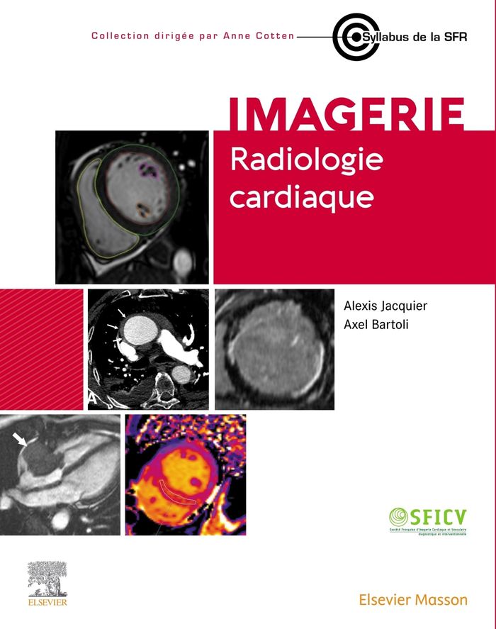 Couverture du livre « Imagerie-radiologie cardiaque » de Alexis Jacquier, librairie Les Contes Infusés à Corte
