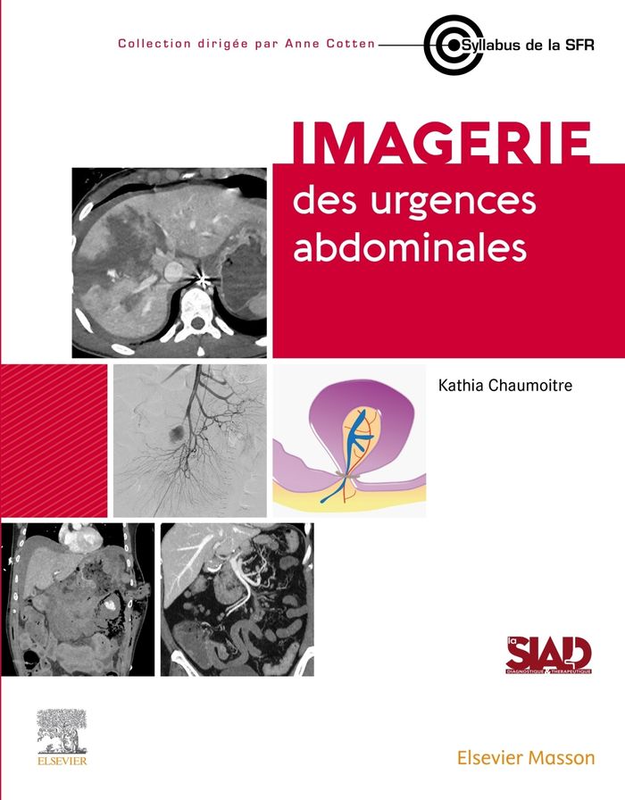 Couverture du livre « Imagerie des urgences abdominales » de Kathia Chaumoitre, librairie Les Contes Infusés à Corte