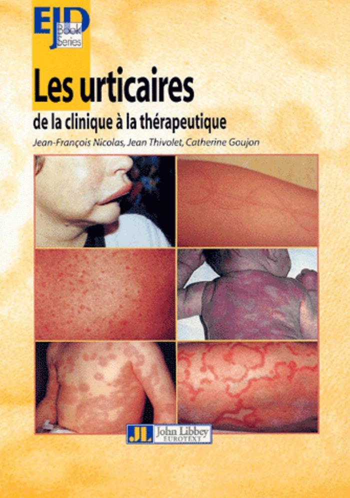 Couverture du livre « LES URTICAIRES-DE LA CLINIQUE A LA THERAPEUTIQUE », librairie Les Contes Infusés à Corte