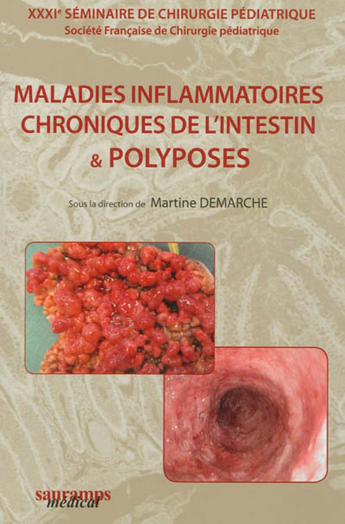Couverture du livre « MALADIES INFLAMMATOIRES CHRONIQUES DE L'INTESTIN & POLYPOSES » de M Demarche, librairie Les Contes Infusés à Corte