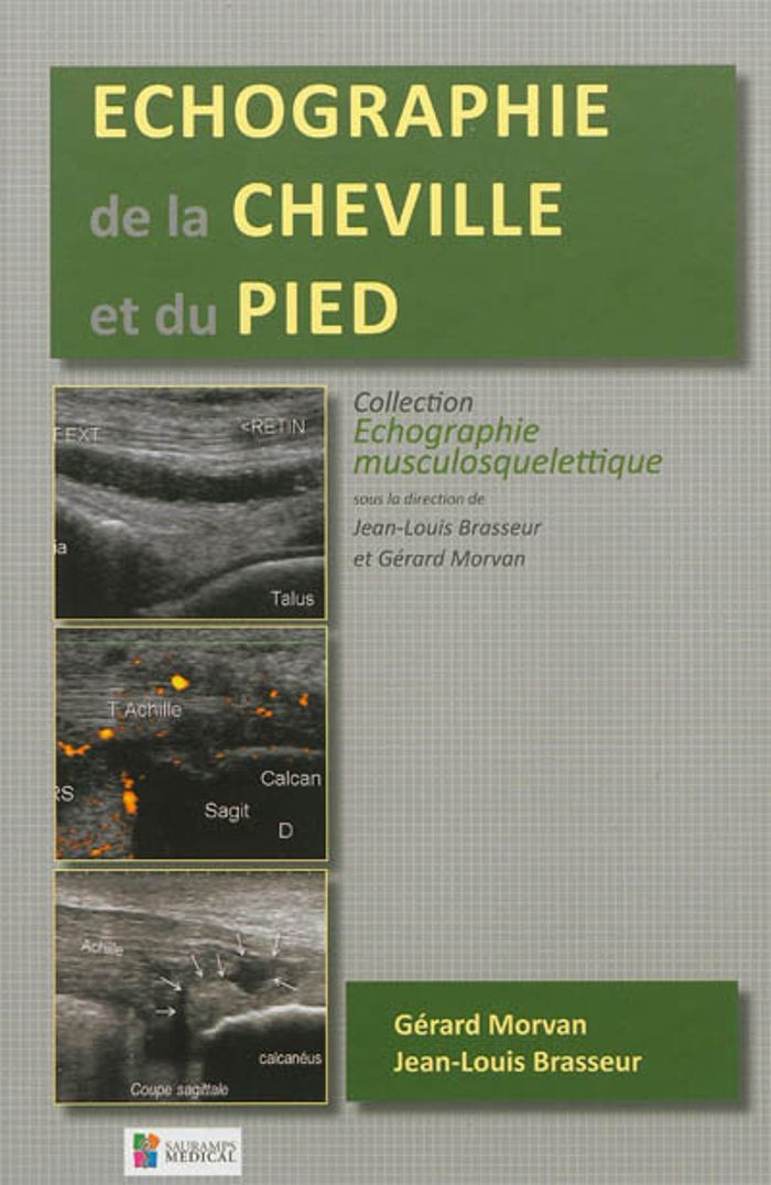 Couverture du livre « ECHOGRAPHIE DE LA CHEVILLE ET DU PIED » de Morvan/brasseur, librairie Les Contes Infusés à Corte