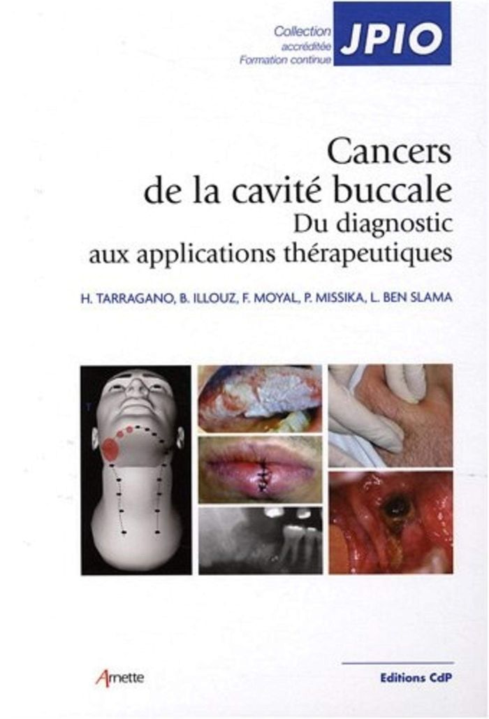 Couverture du livre « CANCERS DE LA CAVITE BUCCALE - DU DIAGNOSTIC AUX APPLICATIONS THERAPEUTIQUES » de Tarragano/illouz, librairie Les Contes Infusés à Corte
