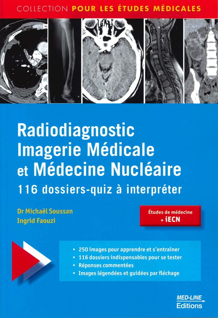Couverture du livre « MED-LINE RADIODIAGNOSTIC IMAGERIE MEDICALE », librairie Les Contes Infusés à Corte