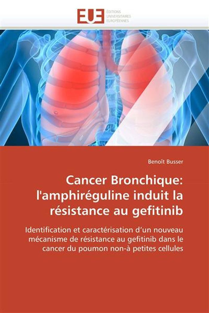 Couverture du livre « CANCER BRONCHIQUE: L'AMPHIREGULINE INDUIT LA RESISTANCE AU GEFITINIB » de Busser-B, librairie Les Contes Infusés à Corte