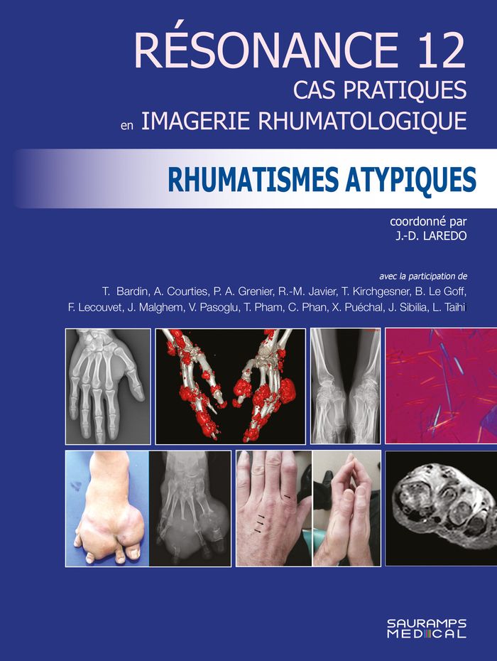 Couverture du livre « Rhumatismes atypiques » de Collectif, librairie Les Contes Infusés à Corte
